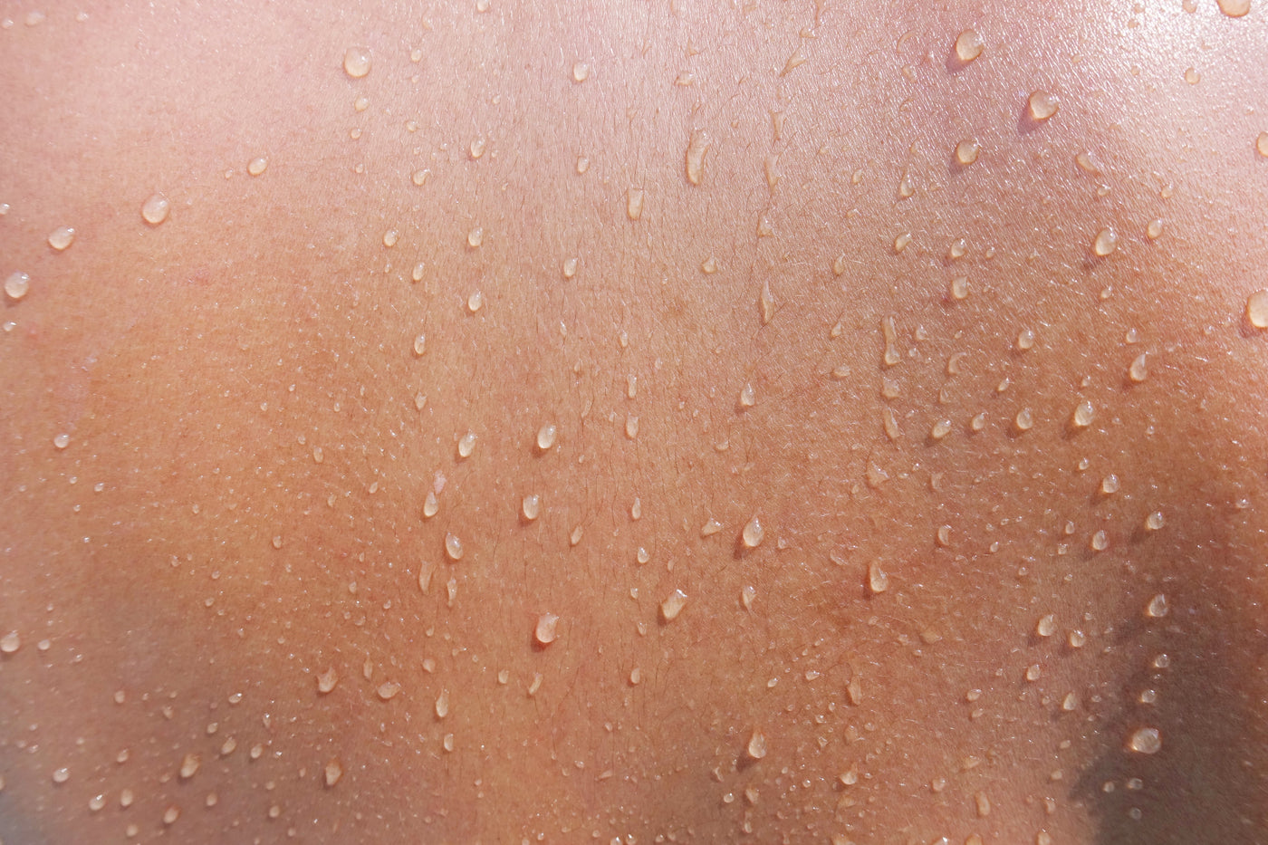 Can a Damaged Skin Barrier Cause Acne?
